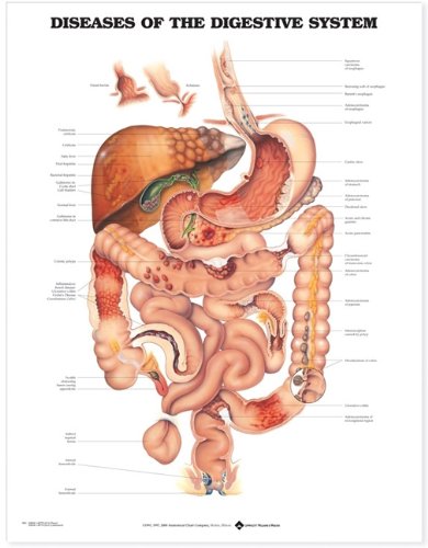 DISEASES OF THE DIGESTIVE SYSTEM ANATOMICAL CHART