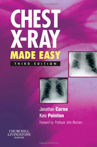 CHEST X-RAY MADE EASY