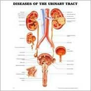 DISEASES OF THE URINARY TRACT ANATOMICAL CHART